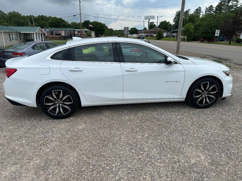 chevrolet malibu 2018 1G1ZD5ST7JF290955 image chevrolet malibu 2018 1G1ZD5ST7JF290955 image