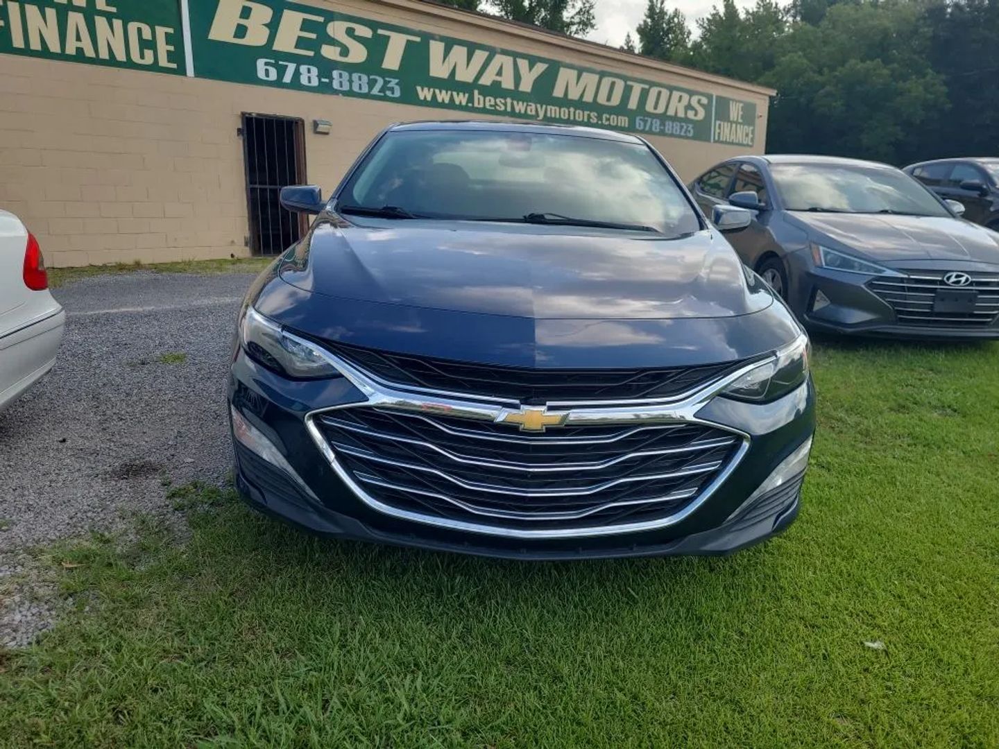 chevrolet malibu 2022 1G1ZD5ST8NF162259 image chevrolet malibu 2022 1G1ZD5ST8NF162259 image
